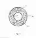 Fig. 06 - Intraocular lens with elastic mask