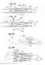 Fig. 04 - Devices, systems and methods for accurate positioning of a prosthetic valve