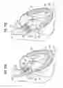 Fig. 06 - Devices, systems and methods for accurate positioning of a prosthetic valve