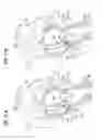 Fig. 07 - Devices, systems and methods for accurate positioning of a prosthetic valve