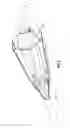 Fig. 04 - Prosthesis, delivery device and methods of use