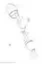 Fig. 11 - Prosthesis, delivery device and methods of use