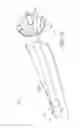 Fig. 13 - Prosthesis, delivery device and methods of use