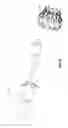 Fig. 22 - Prosthesis, delivery device and methods of use