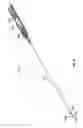 Fig. 29 - Prosthesis, delivery device and methods of use