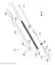 Fig. 30 - Prosthesis, delivery device and methods of use