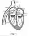 Fig. 02 - Delivery systems with tethers for prosthetic heart valve devices and associated methods