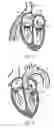 Fig. 03 - Delivery systems with tethers for prosthetic heart valve devices and associated methods