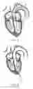 Fig. 04 - Delivery systems with tethers for prosthetic heart valve devices and associated methods