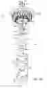 Fig. 05 - Delivery systems with tethers for prosthetic heart valve devices and associated methods