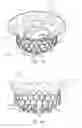 Fig. 14 - Delivery systems with tethers for prosthetic heart valve devices and associated methods