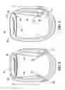 Fig. 04 - Papillary Muscle Position Control Devices, Systems, And Methods