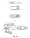 Fig. 12 - Cervical spine fixation apparatus