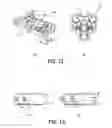 Fig. 13 - Cervical spine fixation apparatus