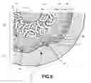 Fig. 03 - Implant with multi-layer bone interfacing lattice