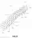 Fig. 20 - Implant with multi-layer bone interfacing lattice