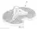 Fig. 10 - ORTHOPAEDIC IMPLANTS AND METHODS