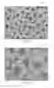 Fig. 16 - ORTHOPAEDIC IMPLANTS AND METHODS