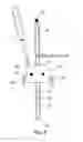 Fig. 05 - Interim joint prosthesis