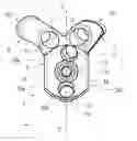 Fig. 01 - Scapular anchor for fixing a glenoid component of a shoulder joint prosthesis to a scapula with compromised anatomy and related method for manufacturing said scapular anchor