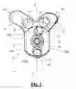 Fig. 02 - Scapular anchor for fixing a glenoid component of a shoulder joint prosthesis to a scapula with compromised anatomy and related method for manufacturing said scapular anchor