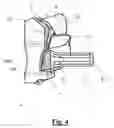 Fig. 05 - Scapular anchor for fixing a glenoid component of a shoulder joint prosthesis to a scapula with compromised anatomy and related method for manufacturing said scapular anchor