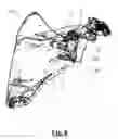 Fig. 09 - Scapular anchor for fixing a glenoid component of a shoulder joint prosthesis to a scapula with compromised anatomy and related method for manufacturing said scapular anchor