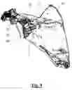 Fig. 10 - Scapular anchor for fixing a glenoid component of a shoulder joint prosthesis to a scapula with compromised anatomy and related method for manufacturing said scapular anchor