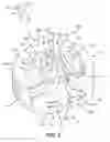 Fig. 07 - Spinal fusion implant