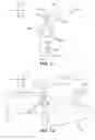 Fig. 11 - Spinal fusion implant
