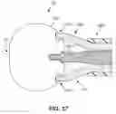 Fig. 34 - Spinal fusion implant