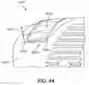 Fig. 41 - Spinal fusion implant