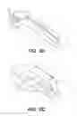 Fig. 03 - Expandable intervertebral implants and methods of installation thereof