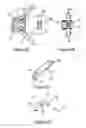 Fig. 03 - Anchoring device for a spinal implant, spinal implant and implantation instrumentation