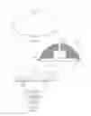 Fig. 03 - Shoulder arthroplasty system method with combination humeral sizer, trial, and guide