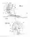 Fig. 05 - Pump mechanism