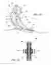 Fig. 12 - Pump mechanism