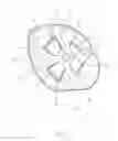 Fig. 04 - Disarticulated compression socket