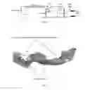 Fig. 16 - Implant stent device