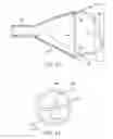 Fig. 15 - Endoluminal prosthesis deployment devices and methods