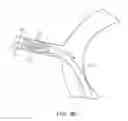 Fig. 17 - Endoluminal prosthesis deployment devices and methods
