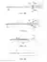 Fig. 20 - Endoluminal prosthesis deployment devices and methods