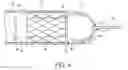 Fig. 06 - EXPANDING SHEATH TIP