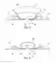 Fig. 03 - Body side member of an ostomy appliance