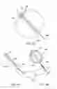Fig. 04 - Three dimensional devices and methods for prolapse alleviation