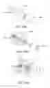 Fig. 12 - Three dimensional devices and methods for prolapse alleviation