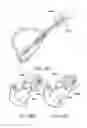 Fig. 23 - Three dimensional devices and methods for prolapse alleviation