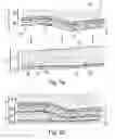 Fig. 06 - WOUND DRESSING WITH ELASTIC PROPERTIES FOR CONTOURING TO THE SHAPE OF A LIMB