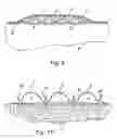 Fig. 07 - WOUND DRESSING WITH ELASTIC PROPERTIES FOR CONTOURING TO THE SHAPE OF A LIMB