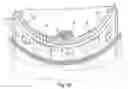 Fig. 17 - WOUND DRESSING WITH ELASTIC PROPERTIES FOR CONTOURING TO THE SHAPE OF A LIMB